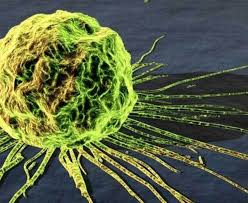 cancer cell under microscop